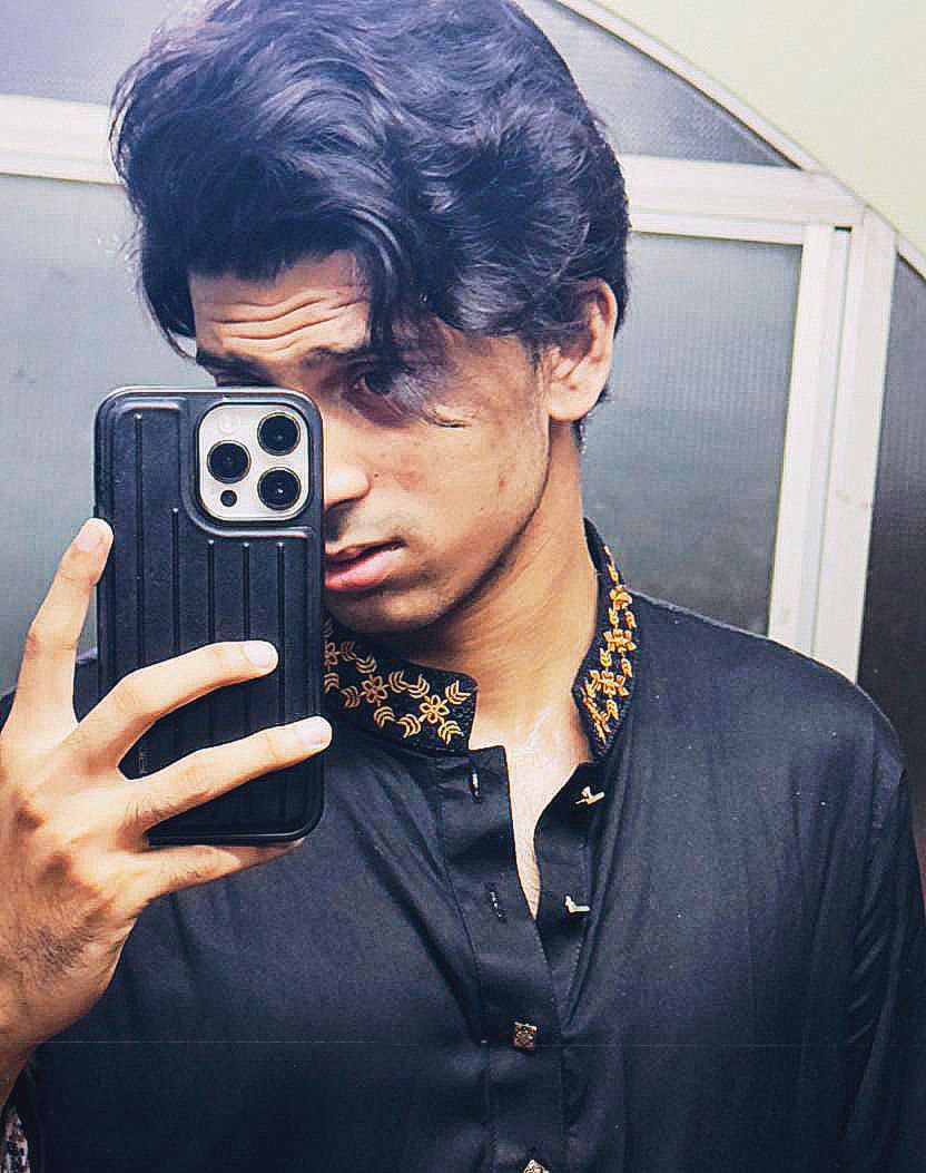 Picture